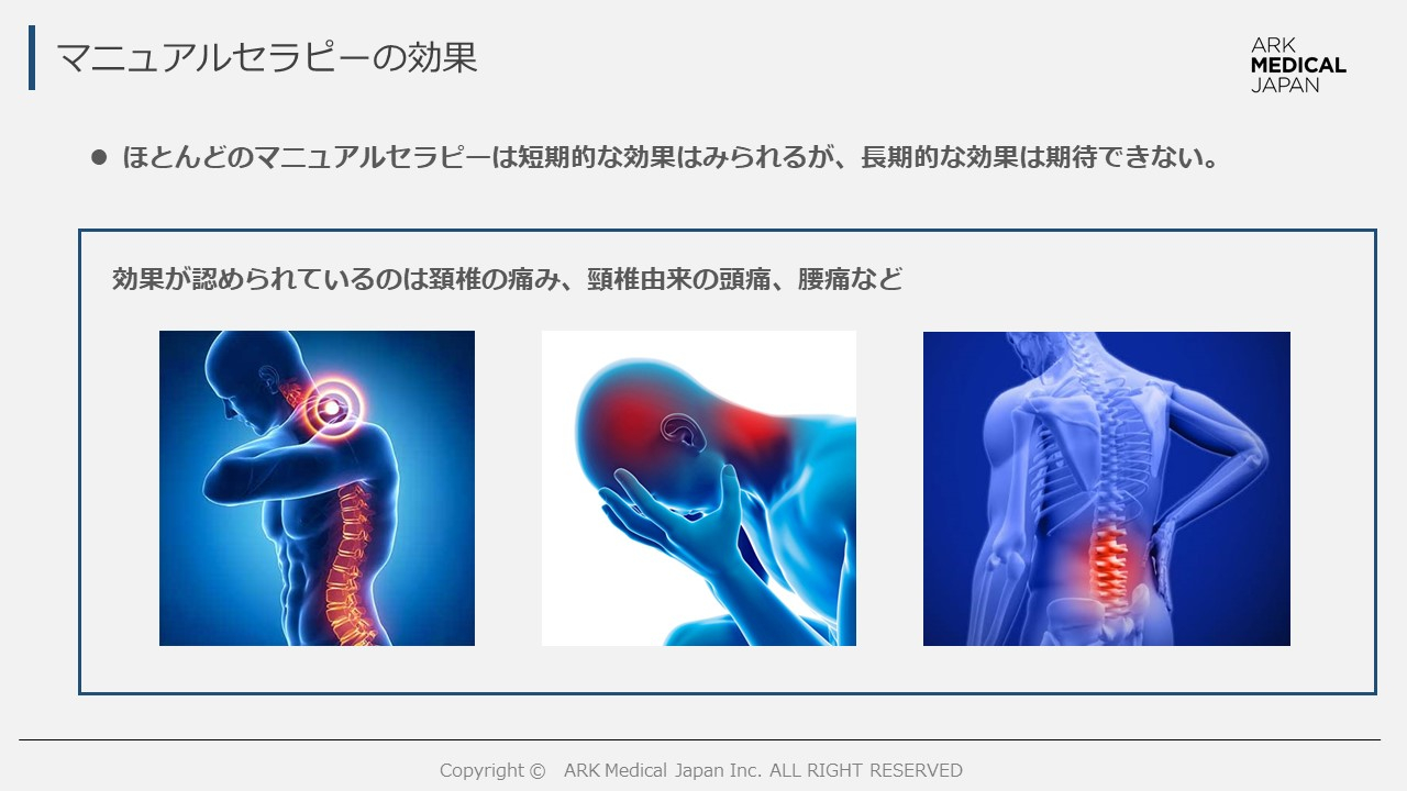 私の考えるマニュアルセラピーとは?(エビデンスも含めて) | XPERT