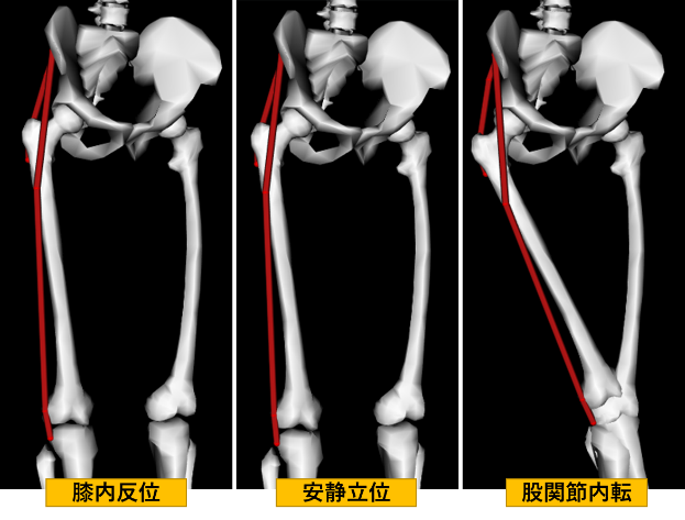 腸脛靭帯って実際には何なのか どんな役割があるのか Xpert