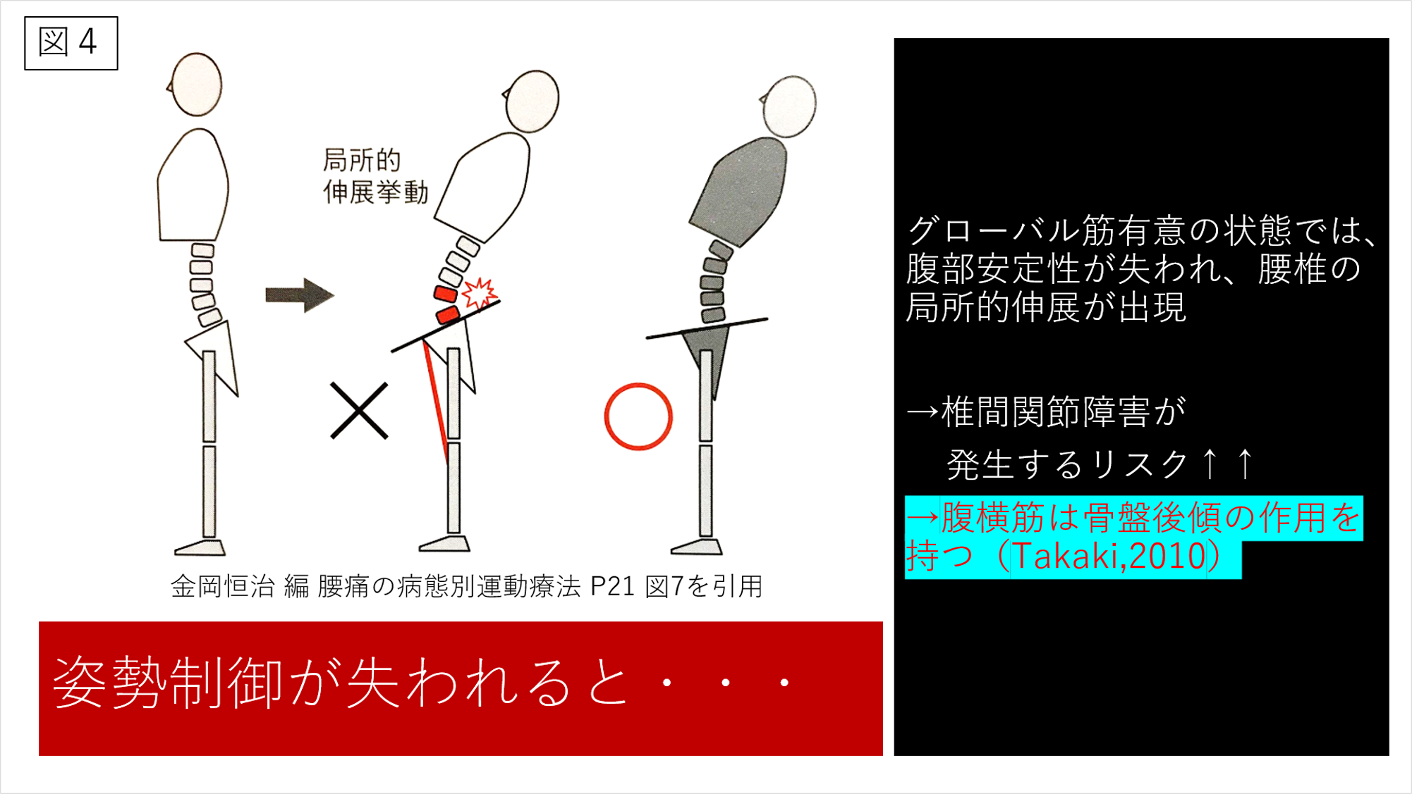 脊椎の分節的安定性のための運動療法 腰痛治療の科学的基礎と臨床