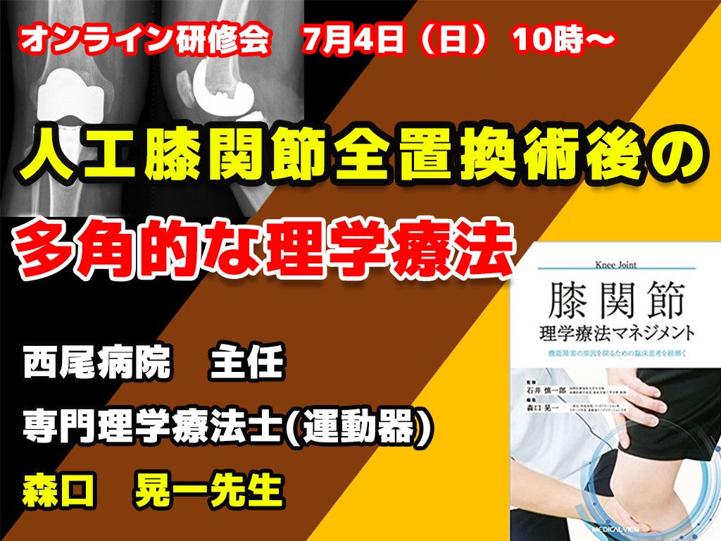 オンラインセミナー】 人工膝関節全置換術後の多角的な理学療法 ｜ XPERT