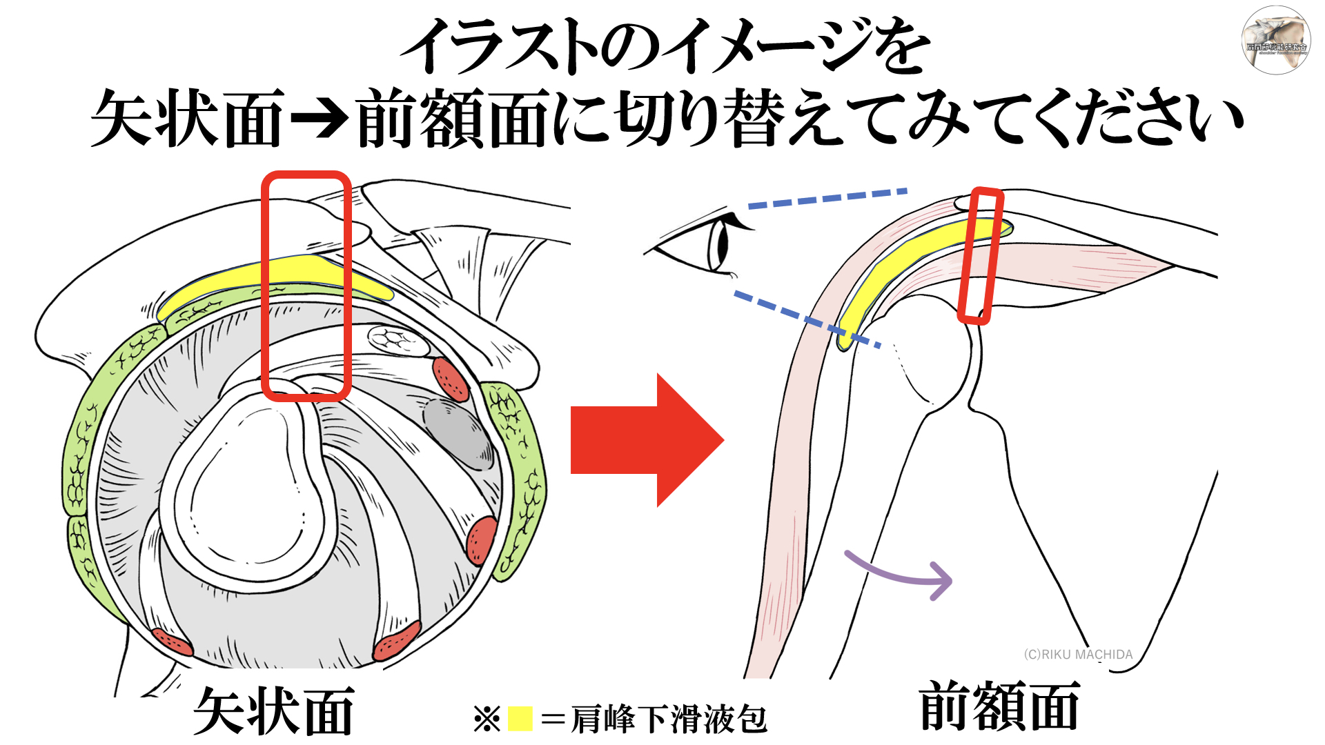 サイズ変更オプション 肩痛・拘縮肩に対するFasciaリリース 肩関節周囲