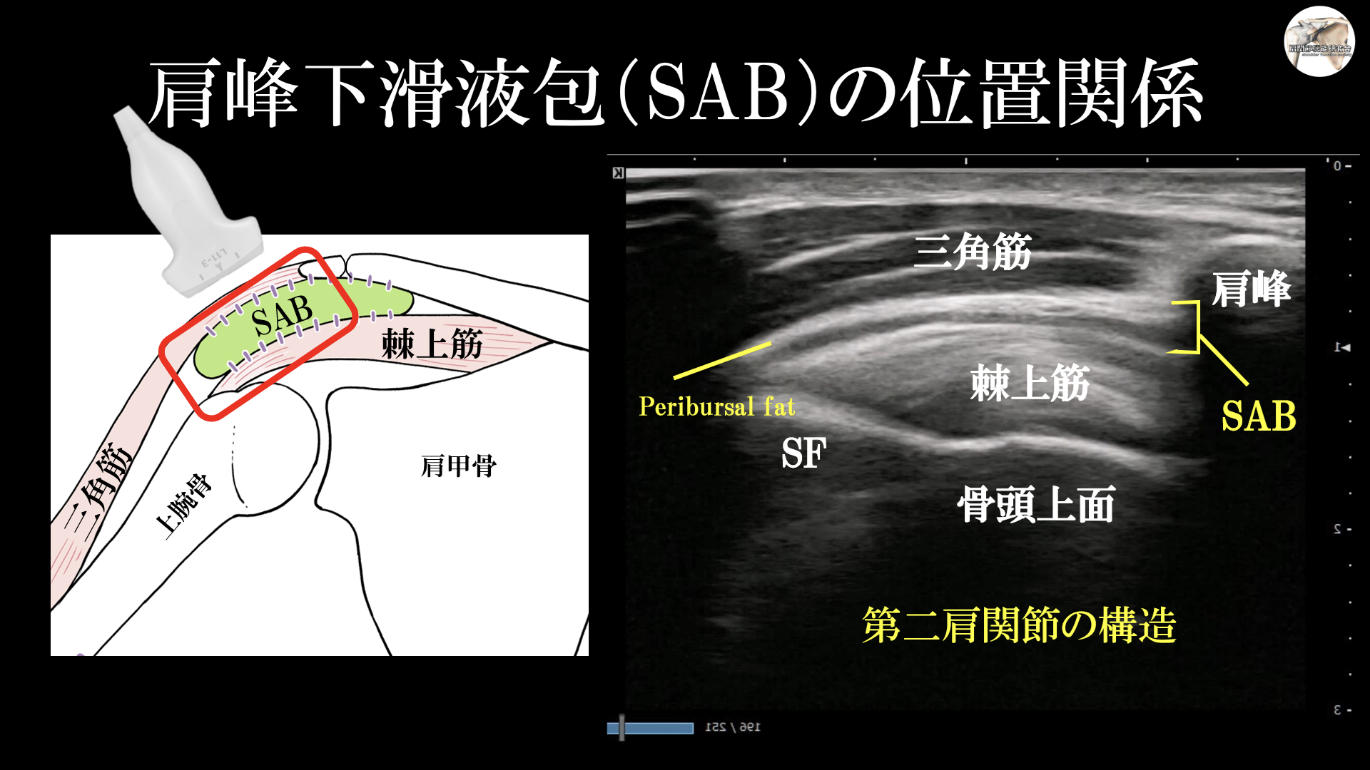 肩峰下滑液包の機能×解剖学（基礎編） ｜ XPERT