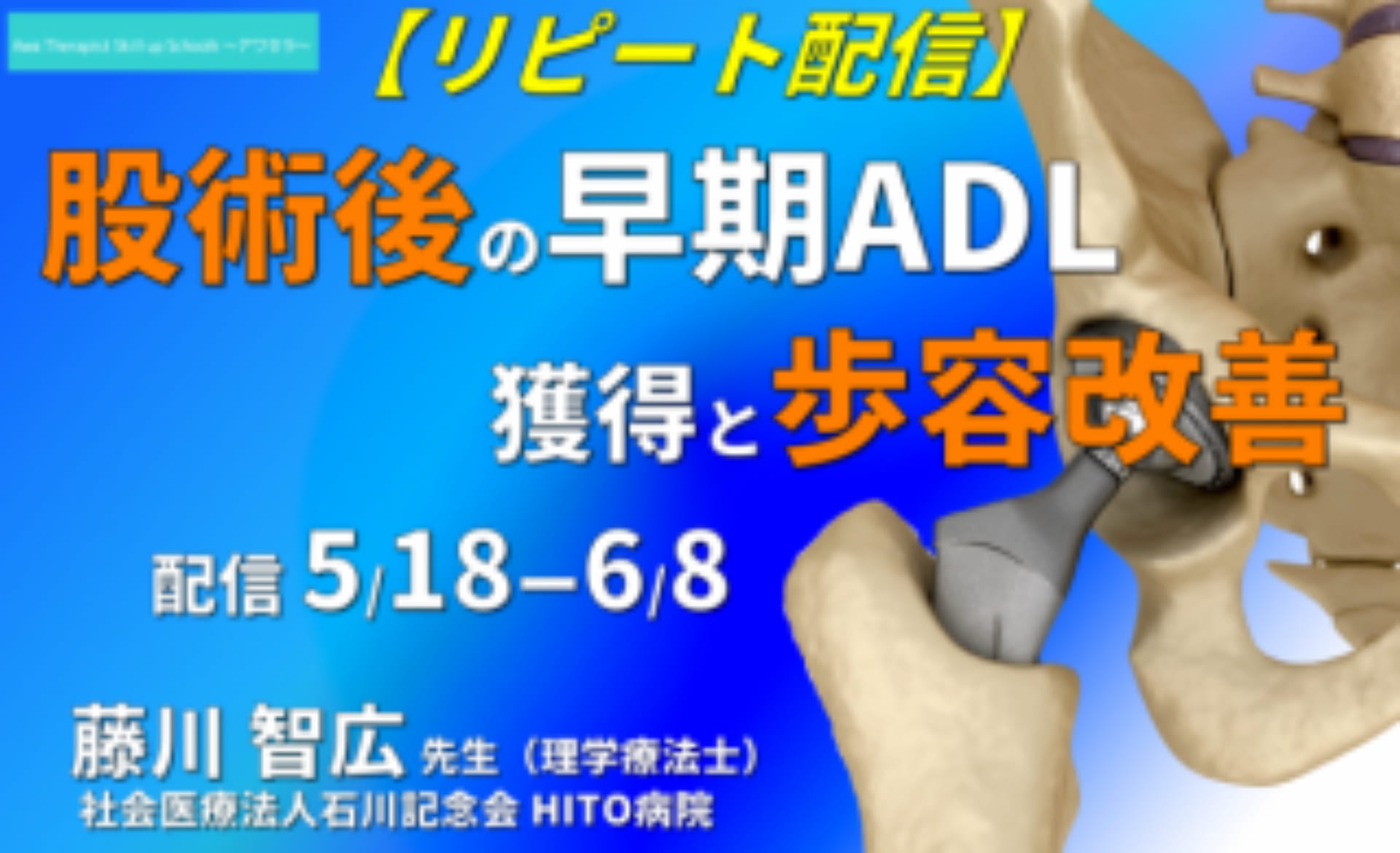 術前 術後リハビリ 股関節疾患術後患者の早期adl獲得と歩容改善に向けた考え方について あぐら動作に着目して 21 5 29開催分 講義時間2時間 アワセラ Awa Therapist Skill Up School 共催 一般社団法人セラピストフォーライフ Xpert