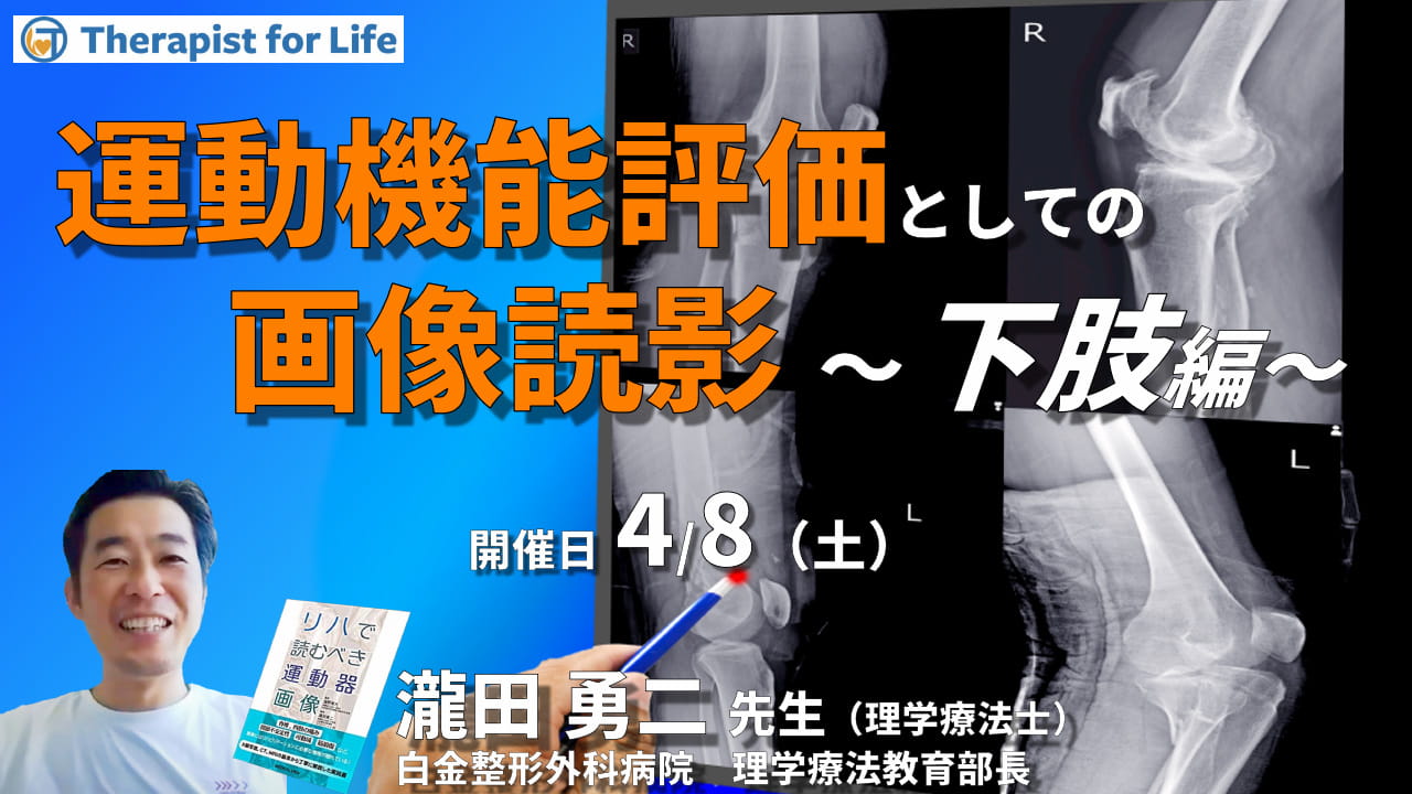 セラピストのための運動機能評価としての画像の読影（下肢編）～評価精度の向上、治療方針の明確化 講師：瀧田勇二先生 ｜ XPERT