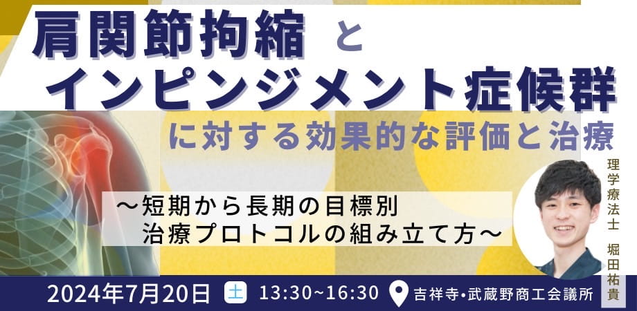 肩関節拘縮・インピンジメント症候群の評価・治療 ｜ XPERT