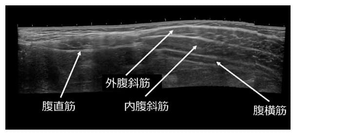 運動器エコー -骨格筋評価のために必要な知識とその可能性-｜中村雅俊
