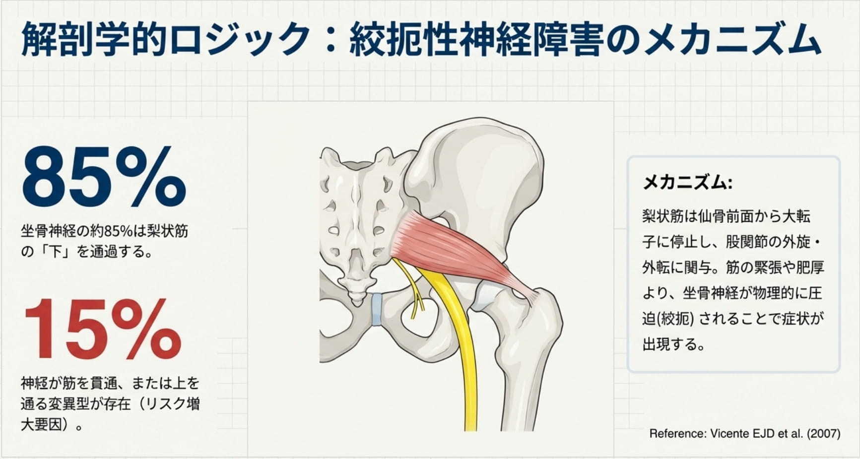 梨状筋症候群テスト｜6つの鑑別法のポイントを徹底解説 ｜ XPERT