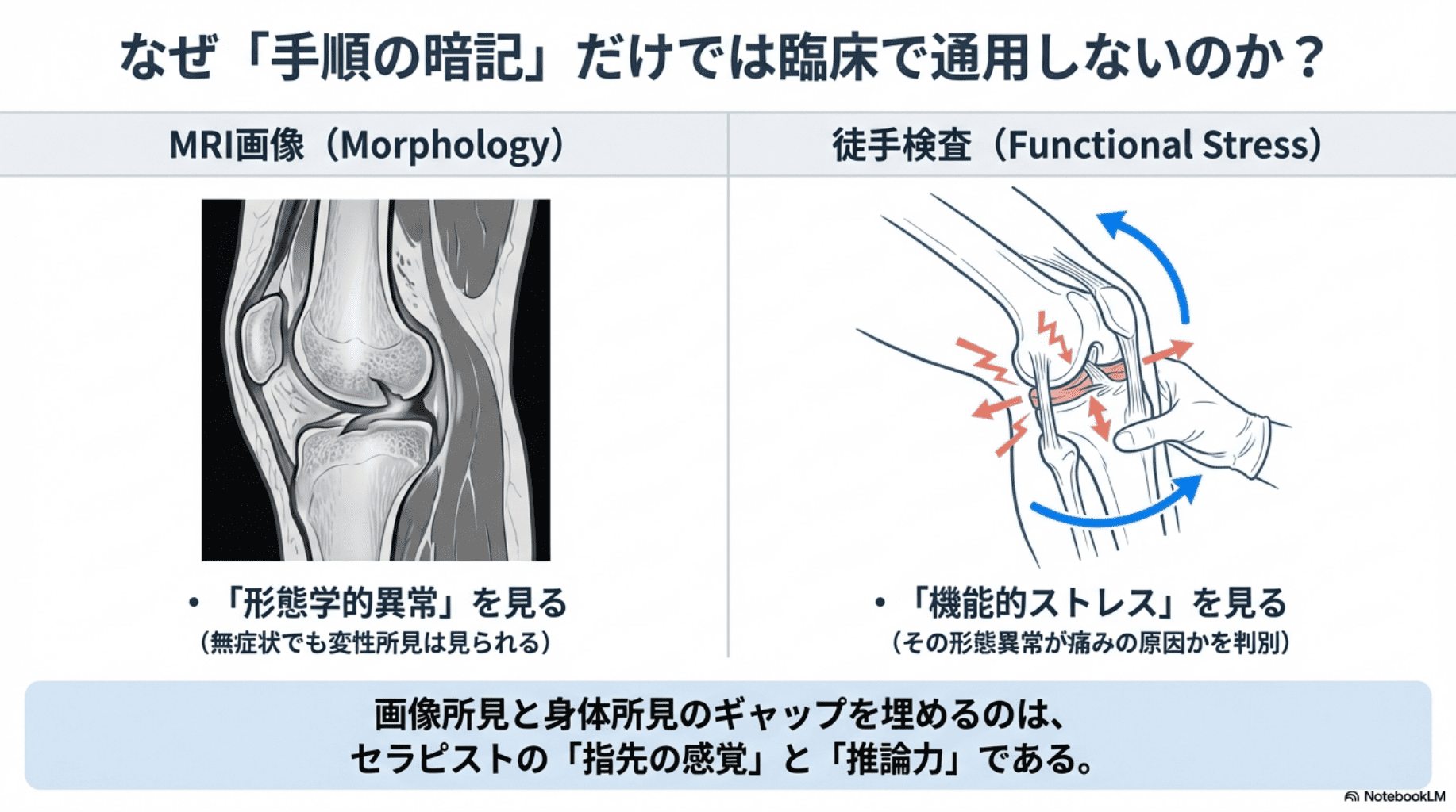 半月板損傷の徒手検査｜マクマレー・アプレー・テサリーテストの根拠と