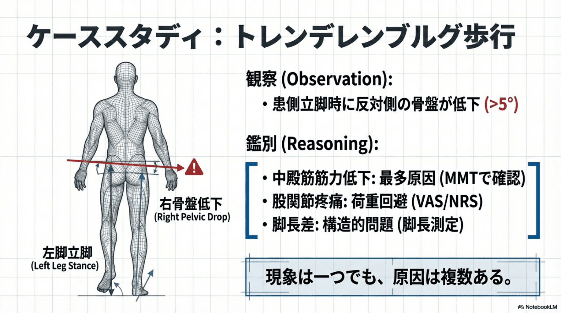 新人理学療法士向け】歩行分析が苦手な人のための完全ガイド｜3