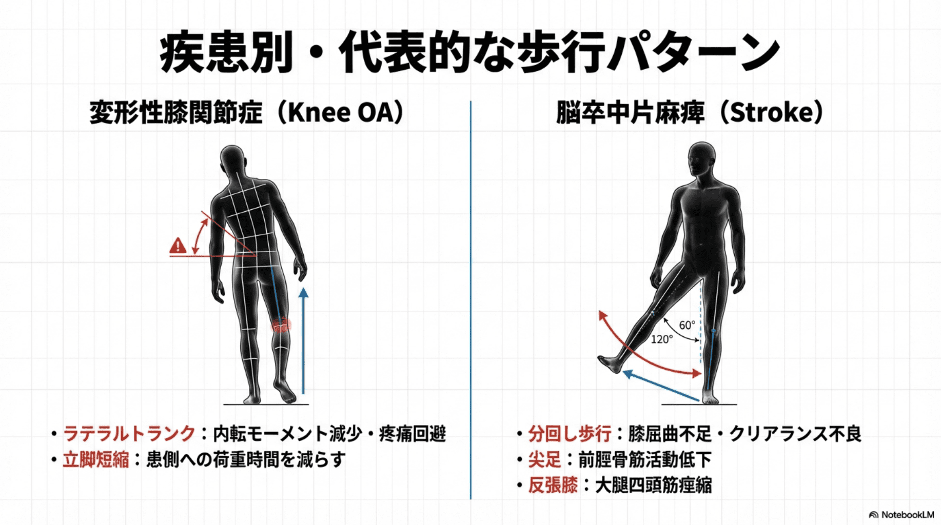 理学療法マネジメント 足 膝 股関節 脊柱 観察による歩行分析など 足部