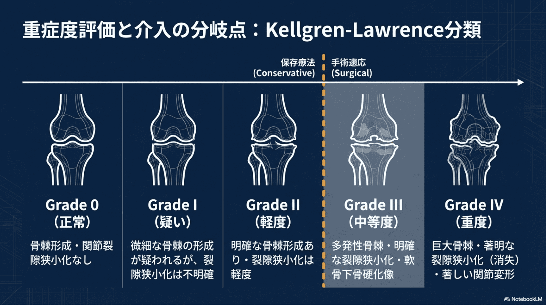 2026年版】変形性膝関節症リハビリ完全ガイド｜PT・OTが教える運動療法