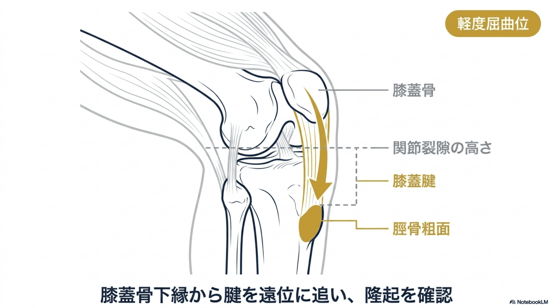 触診が苦手なセラピストへ【膝関節編】──ROM制限因子を見極める骨